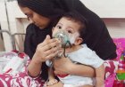 The death toll from measles has risen to 280, with a growing number of cases showing symptoms