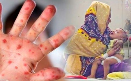 Five children die with measles-like symptoms within 24 hours